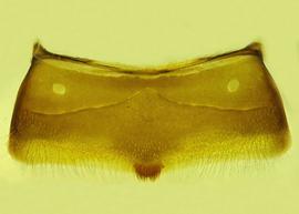   Anthidium maculifrons  male, ventral view of fourth sternum (S4), photo: Victor Gonzalez 
